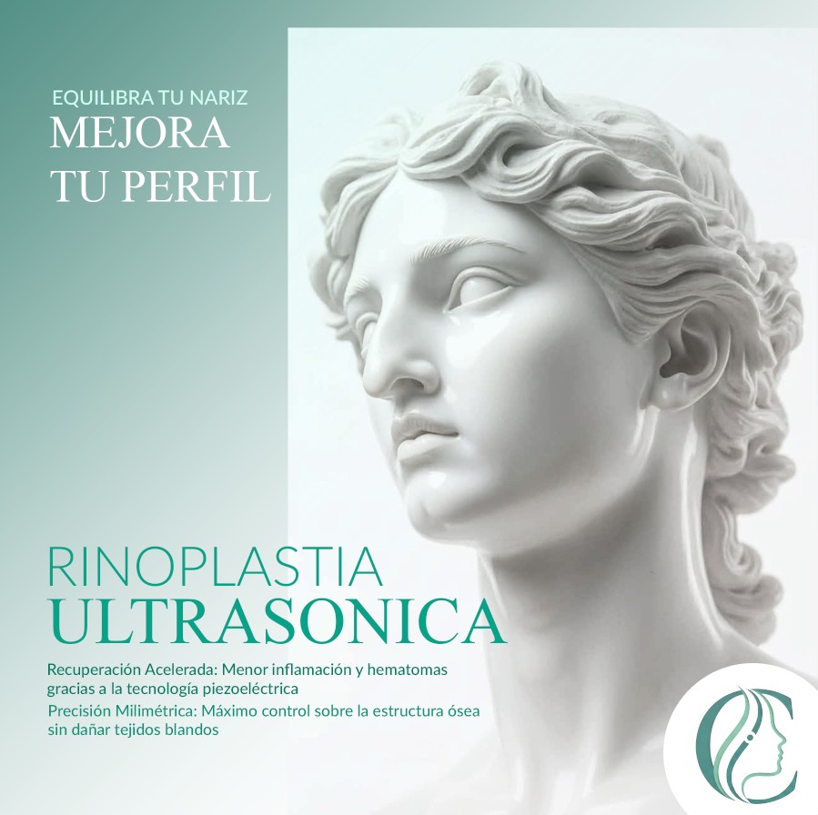 rinoplastia